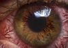 Glaucoma Tratamiento - Enfermedad Glaucoma
