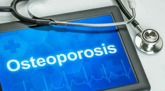 Que es la Osteoporosis - Como Evitar la Osteoporosis