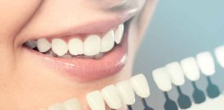 Blanqueamiento Dental - Salud con un Blanqueamiento Dental
