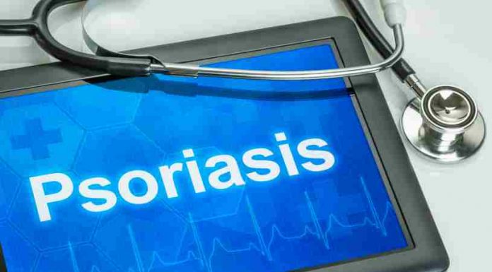 Remedios para la Psoriasis - Mejorar la Psoriasis