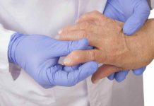 Remedios para la Artritis - Cuidados Artritis